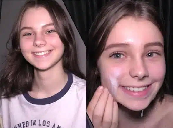 Tratamiento facial para una adolescente de 18 años
